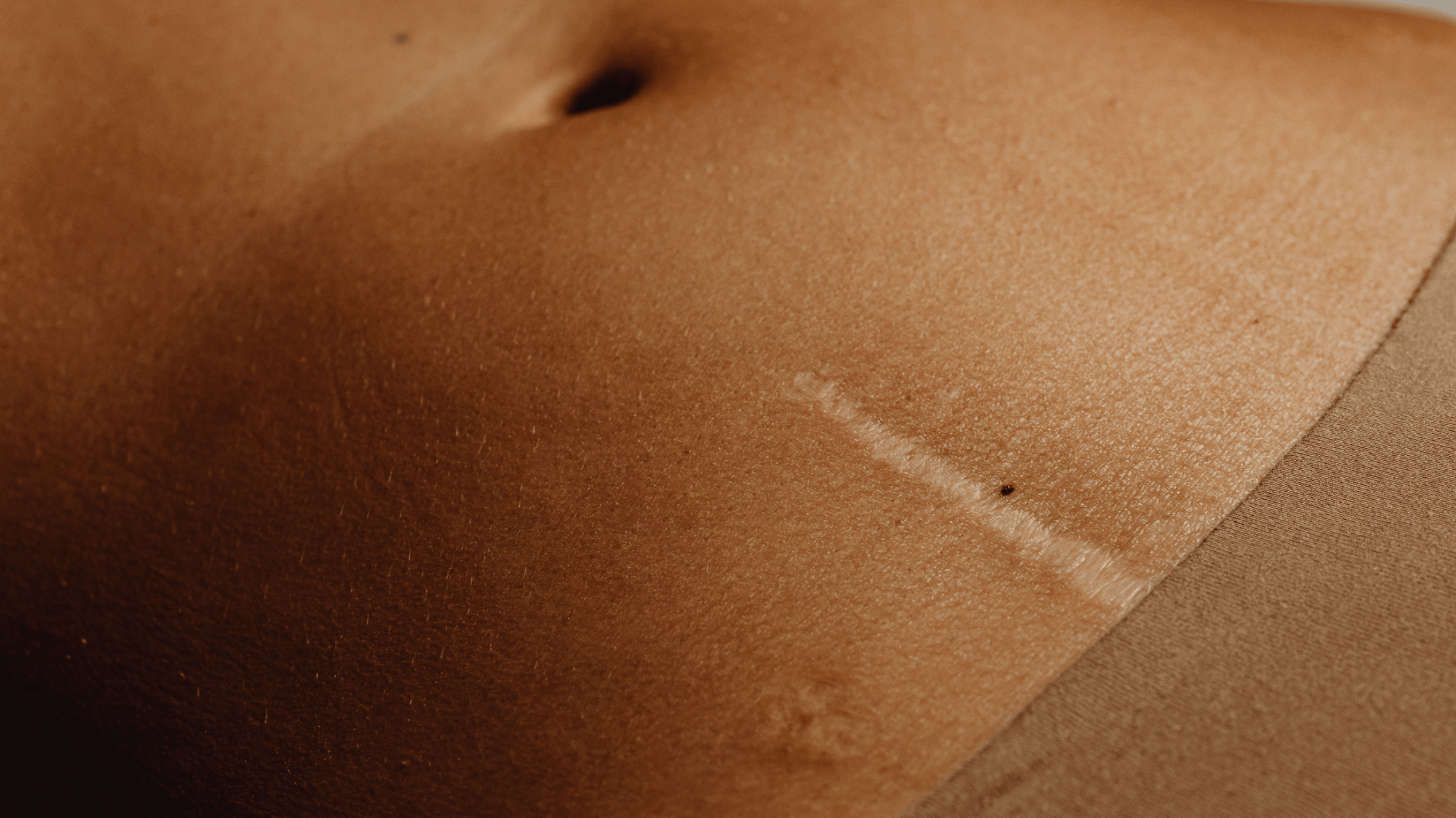 Finding Soothing Solutions for Sensitive Skin