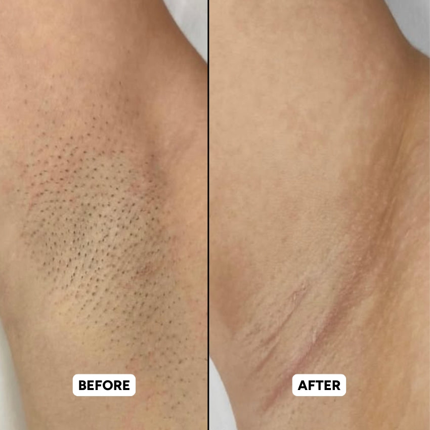 The Complete Intimate Skin Reset Before