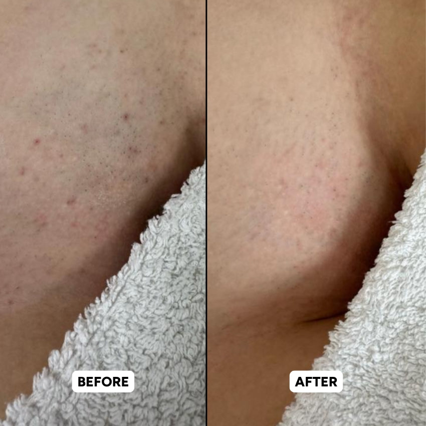 The Complete Intimate Skin Reset Before