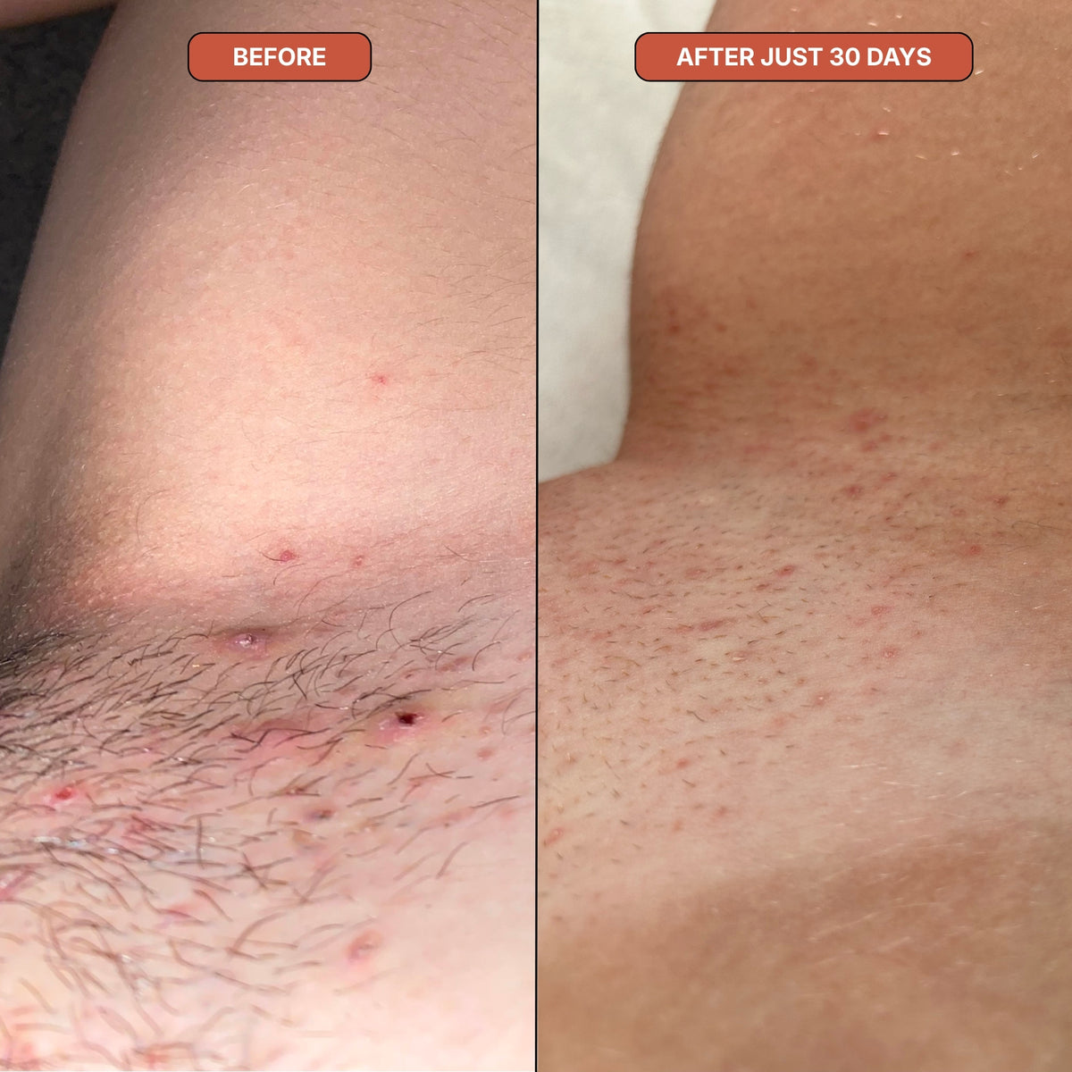 Oyo Skincare