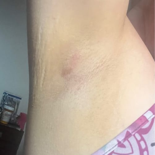 Dark Spots Routine After