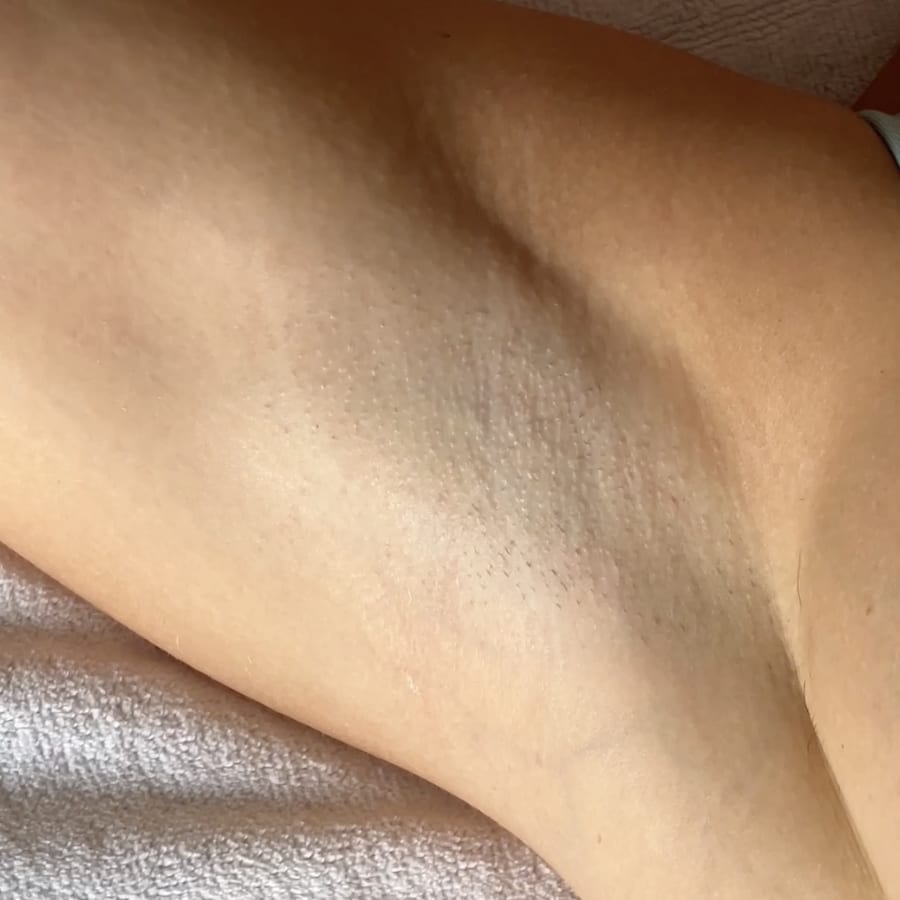 The Ultimate Hair Removal Routine After