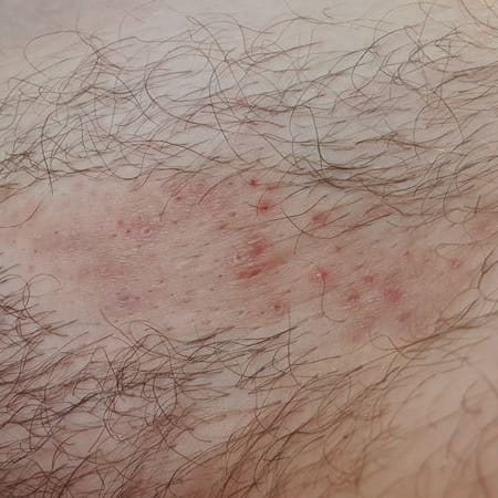 The Complete Intimate Skin Reset Before