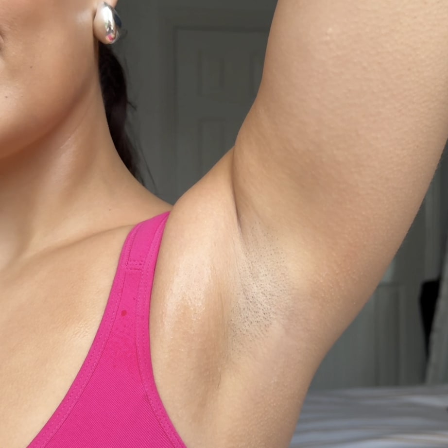 The Ultimate Hair Removal Routine After