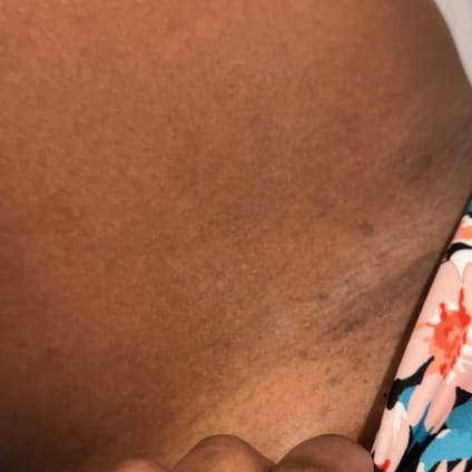Dark Spots Routine After