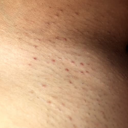 The Complete Intimate Skin Reset Before