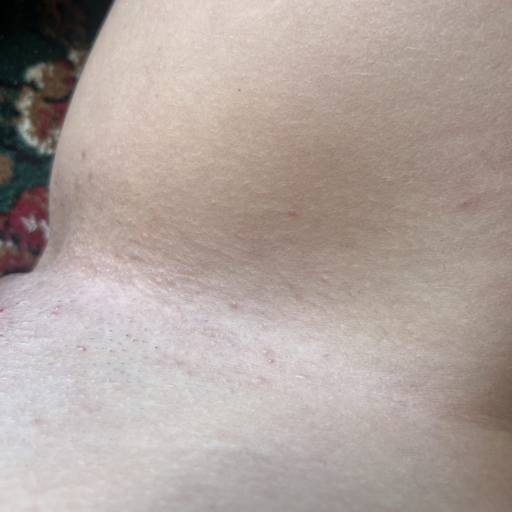 The Complete Intimate Skin Reset After