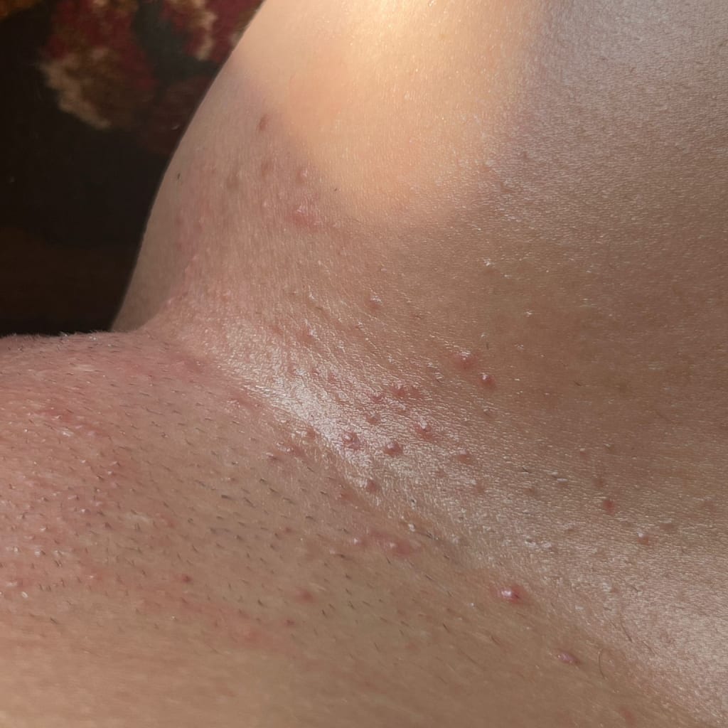 The Complete Intimate Skin Reset Before