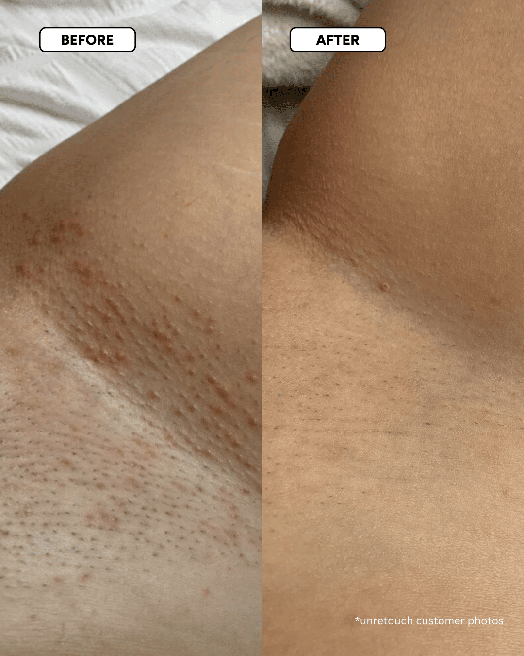 The Smooth Skin System