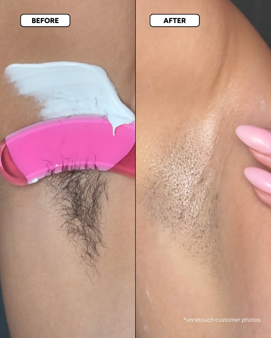 The Smooth Skin System