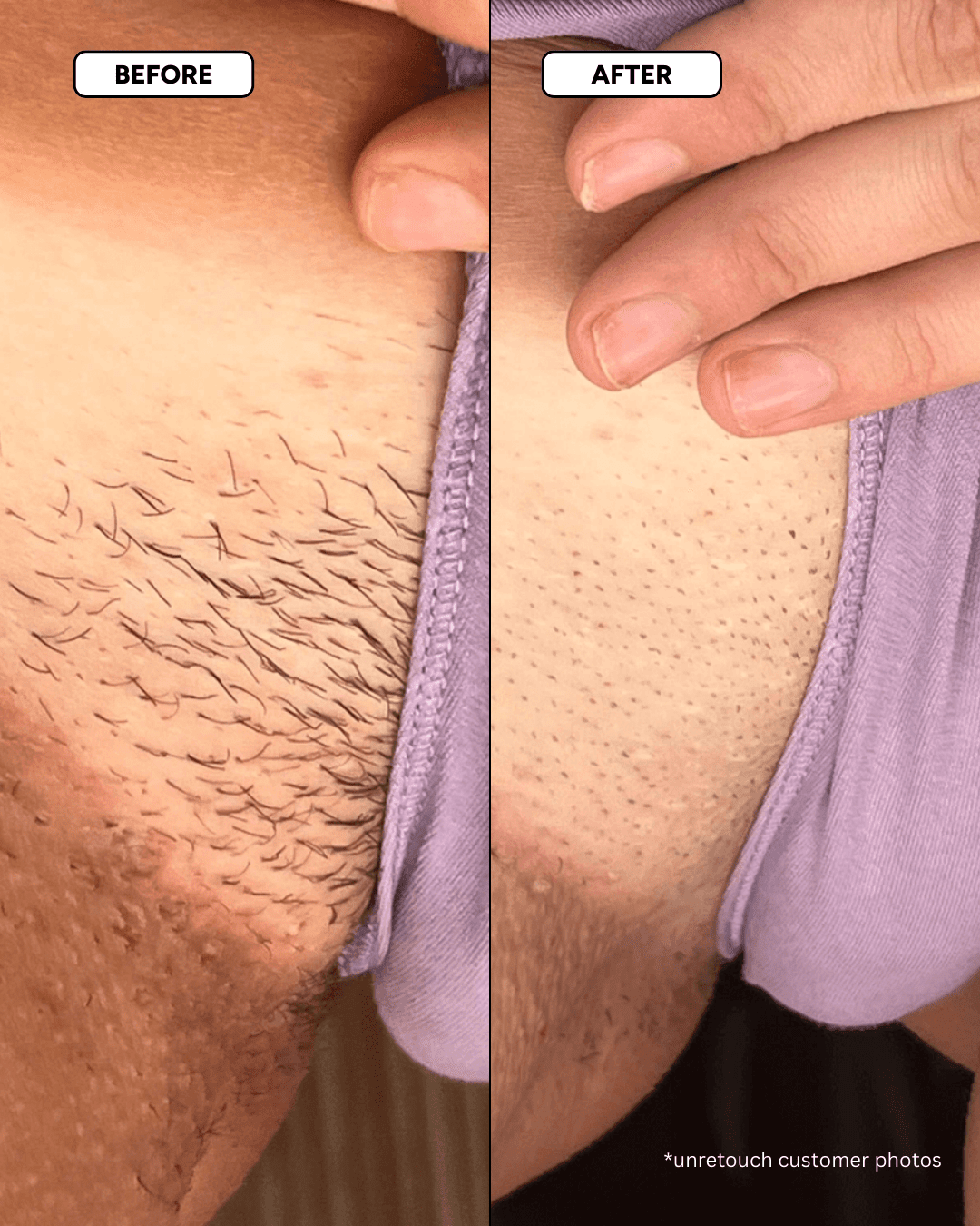 The Smooth Skin System