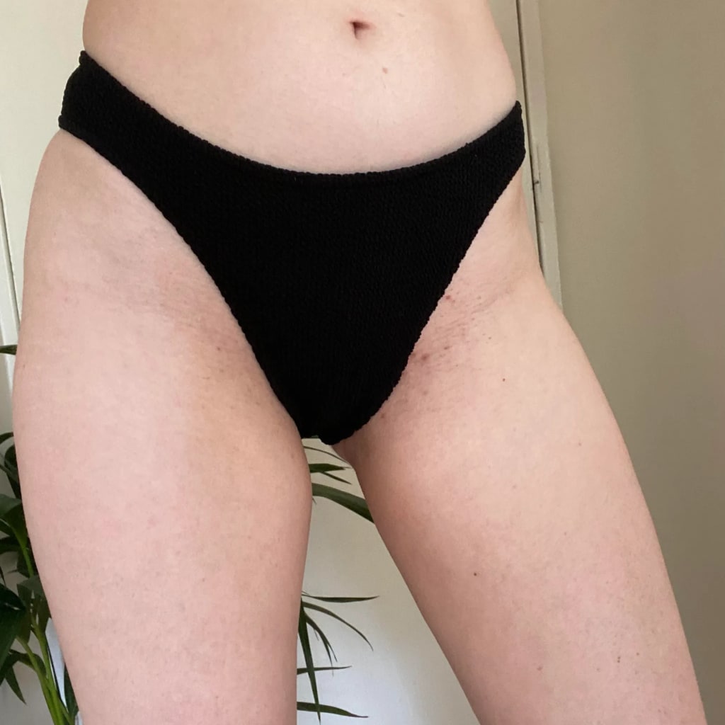 The Complete Intimate Skin Reset Before