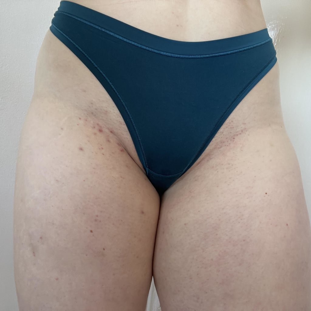 The Complete Intimate Skin Reset Before