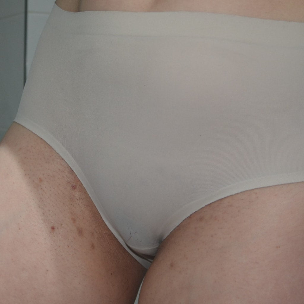 The Complete Intimate Skin Reset After