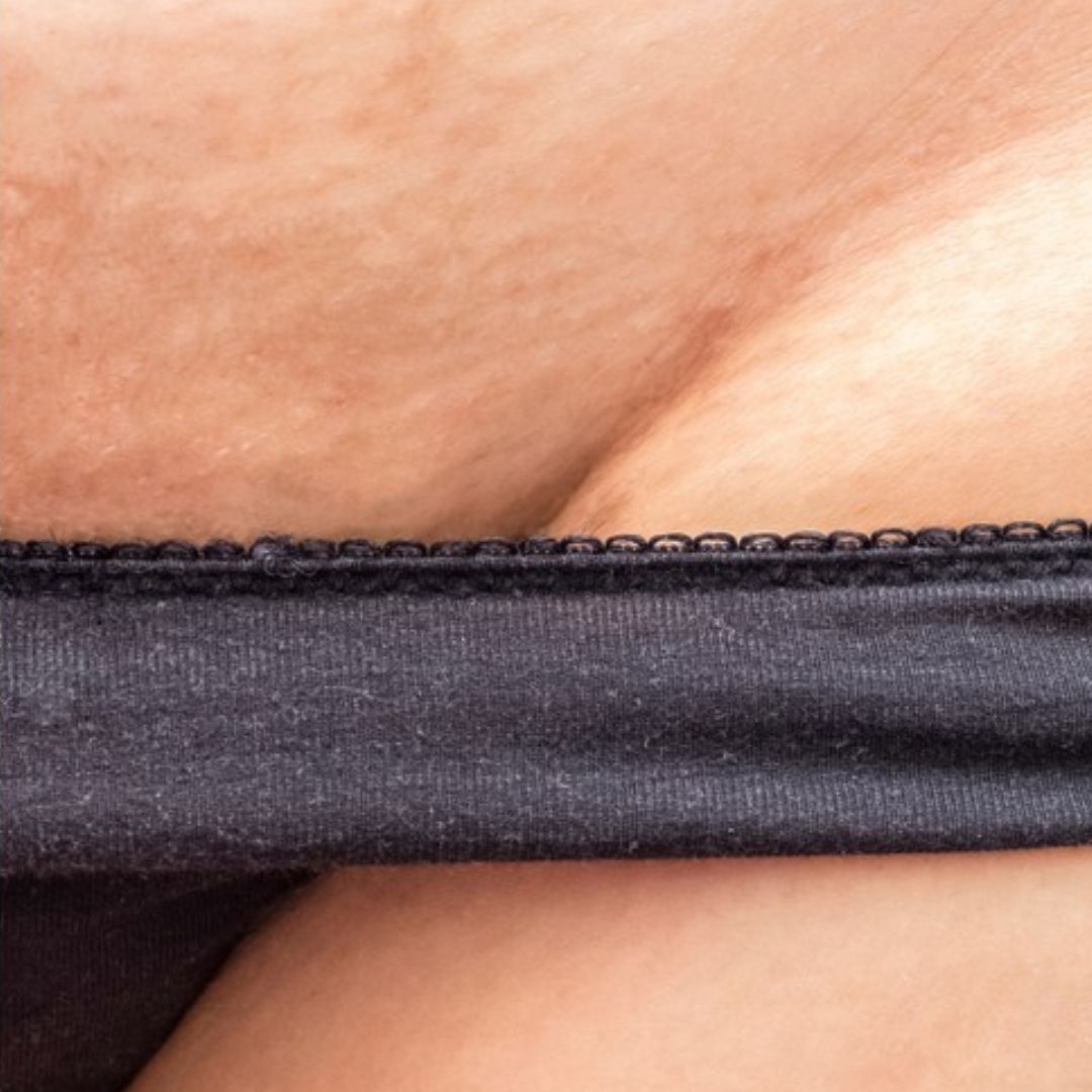 The Intimate IPL Routine After