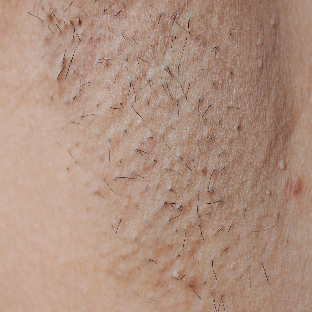 The Intimate IPL Routine Before