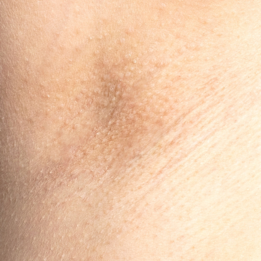 The Intimate IPL Routine After