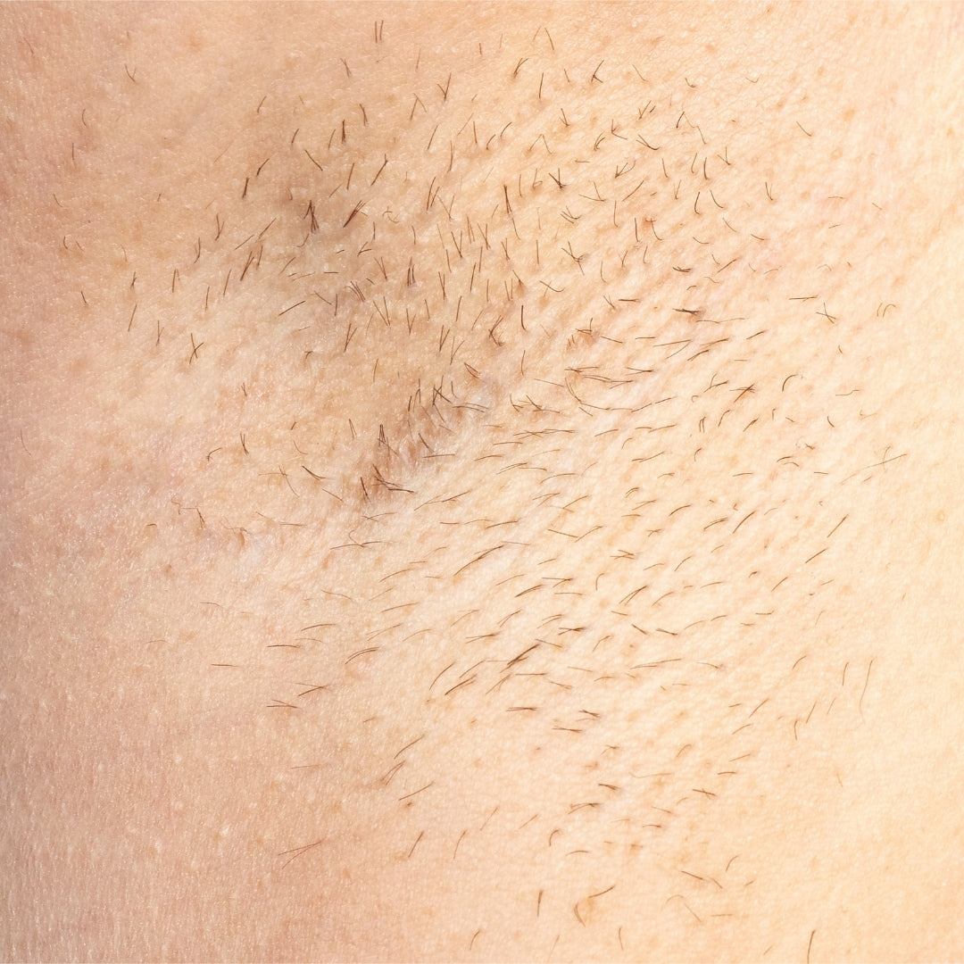 The Intimate IPL Routine Before