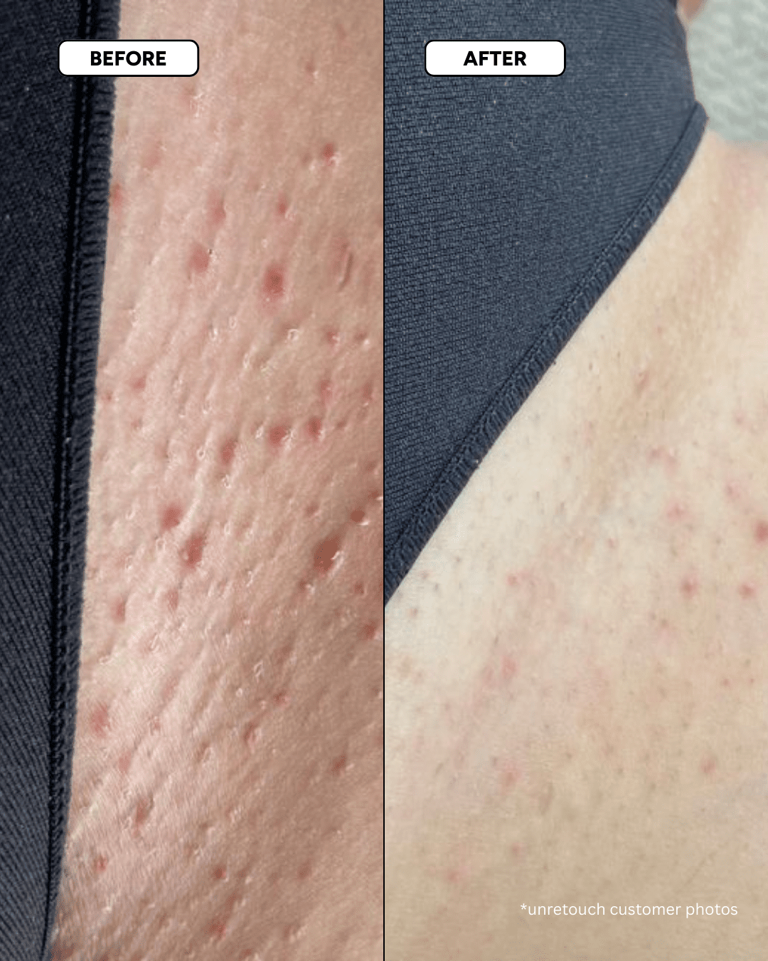 The Smooth Skin System