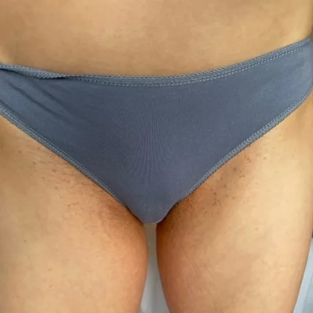 Ingrown Rescue Routine Before