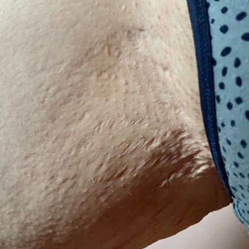 The Complete Intimate Skin Reset Before