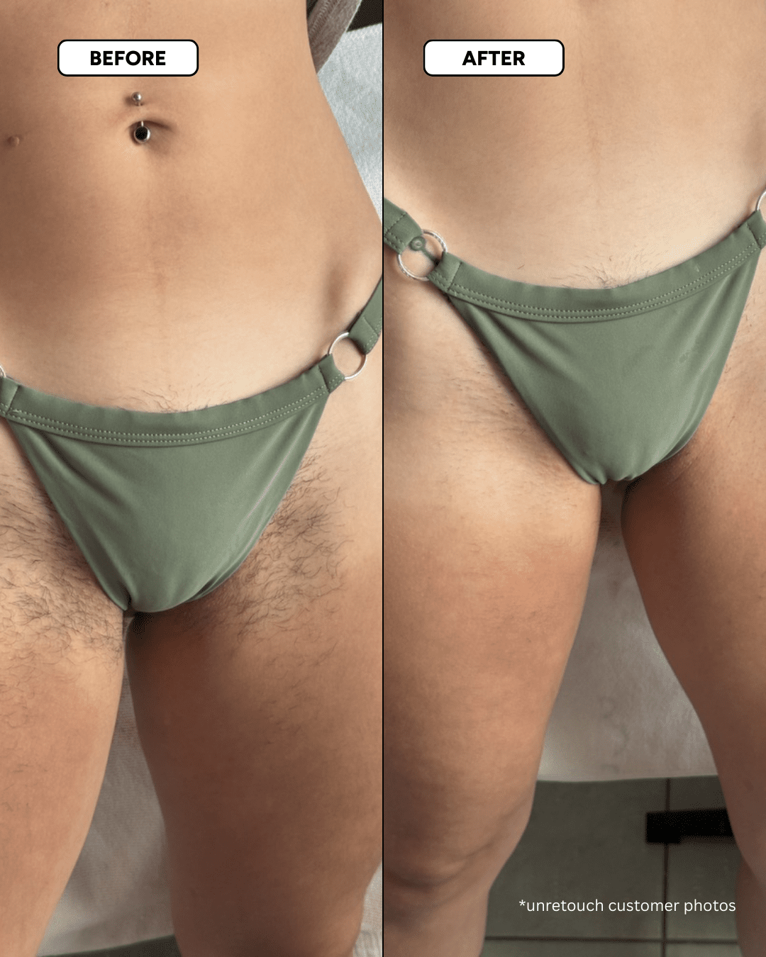 The Smooth Skin System