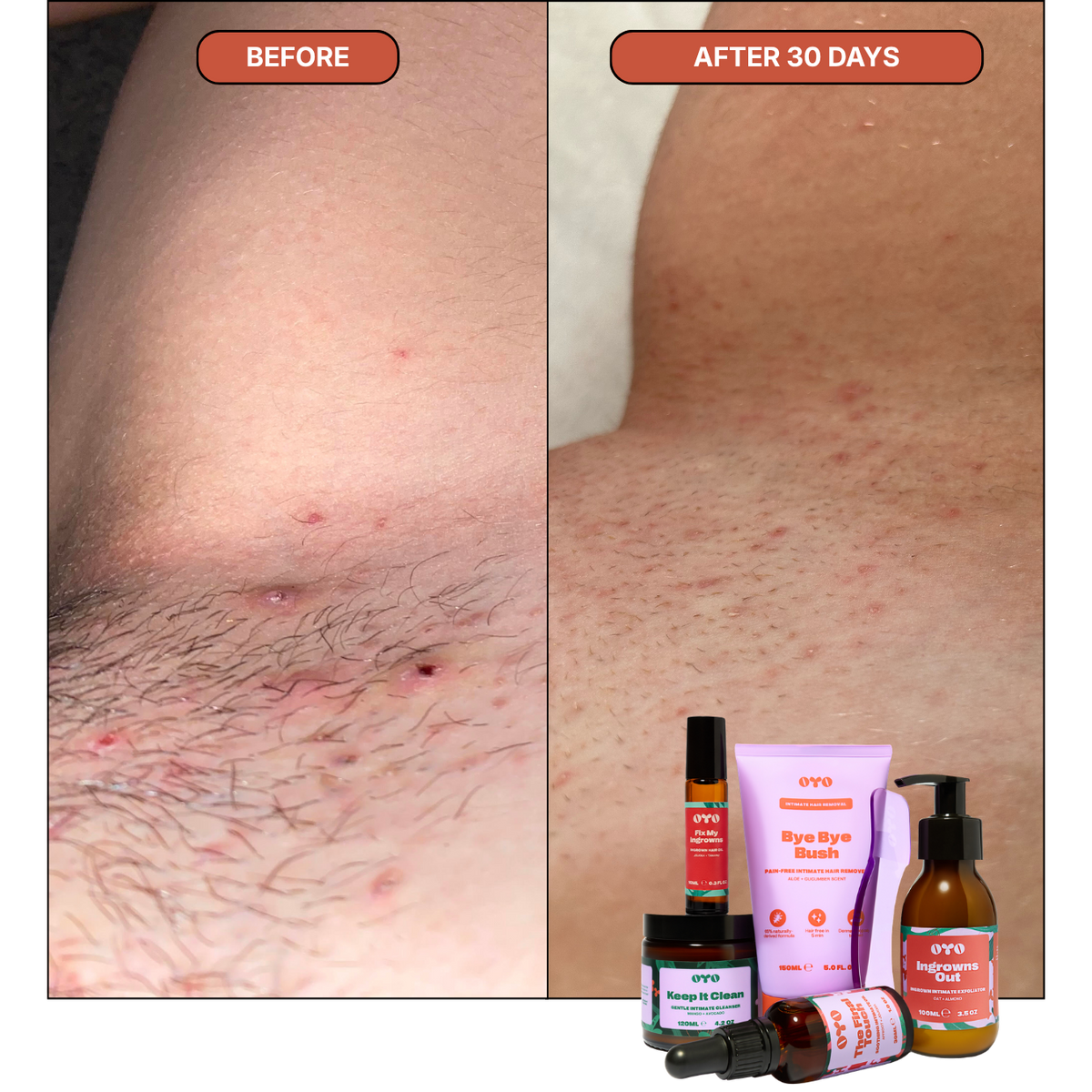 Oyo Skincare