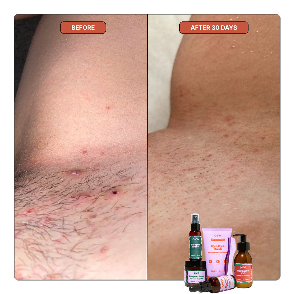 Oyo Skincare