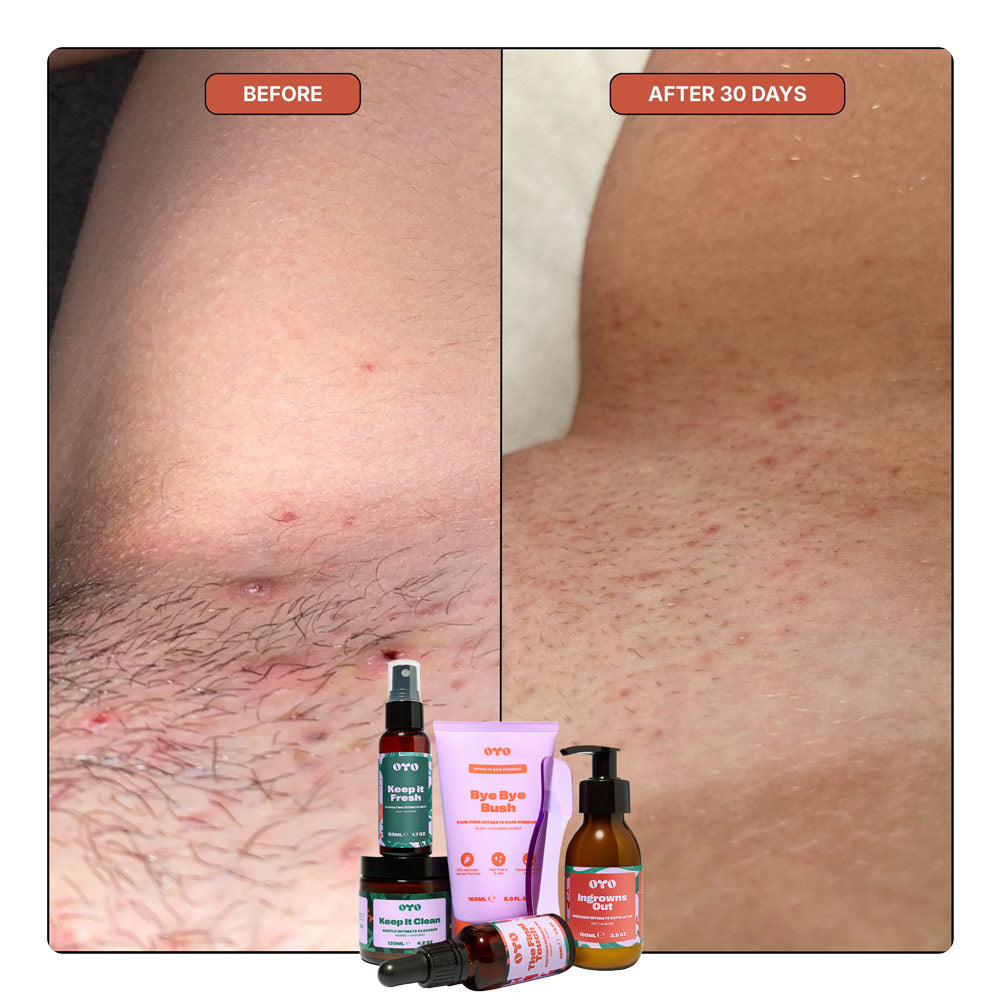Oyo Skincare