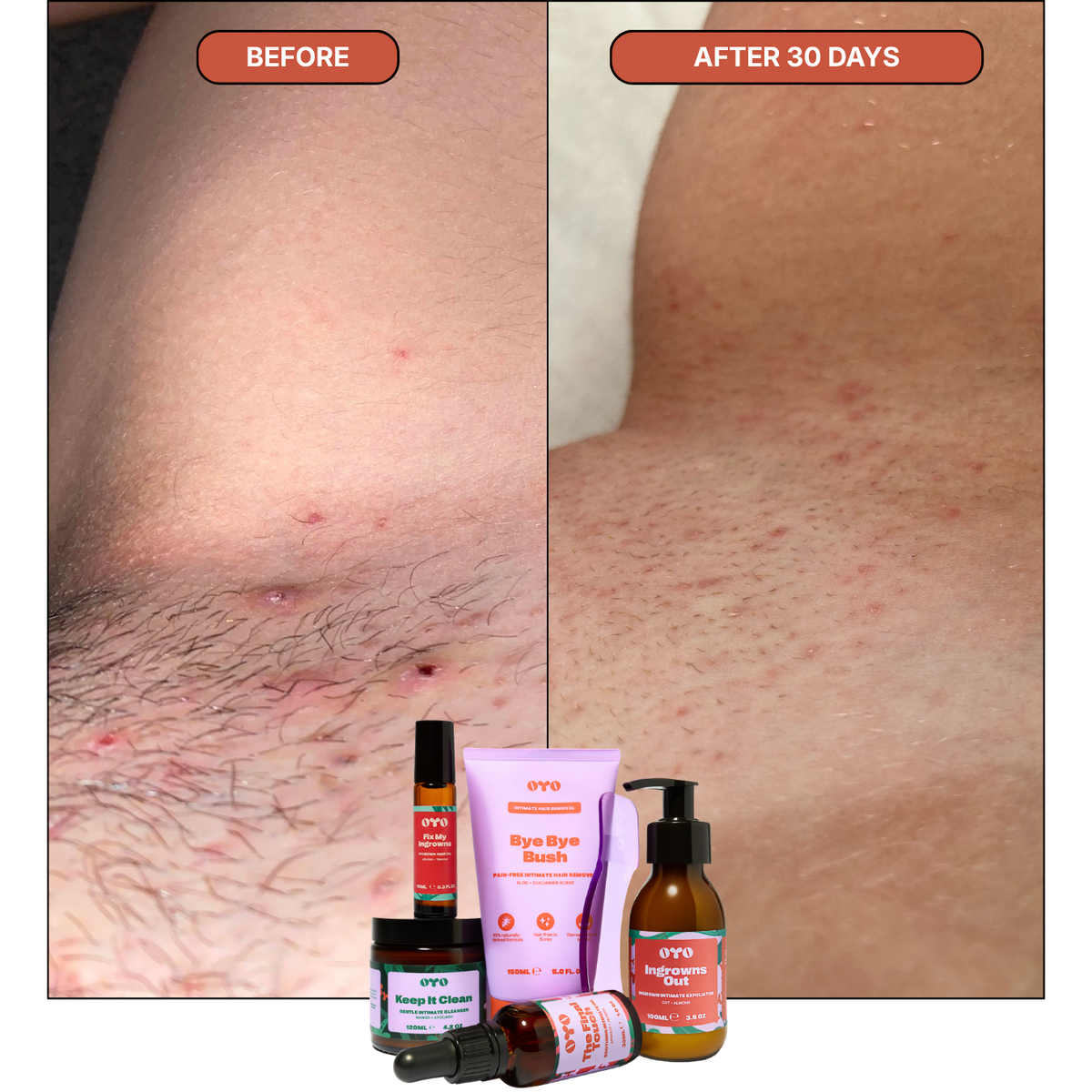 Oyo Skincare